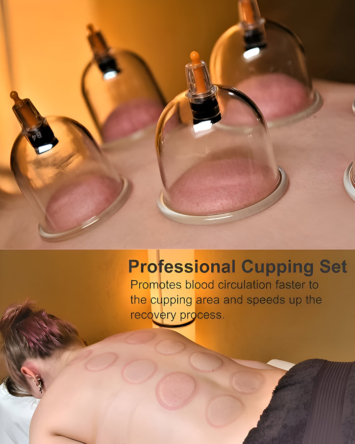 Cupping Therapy Set - Vacuum