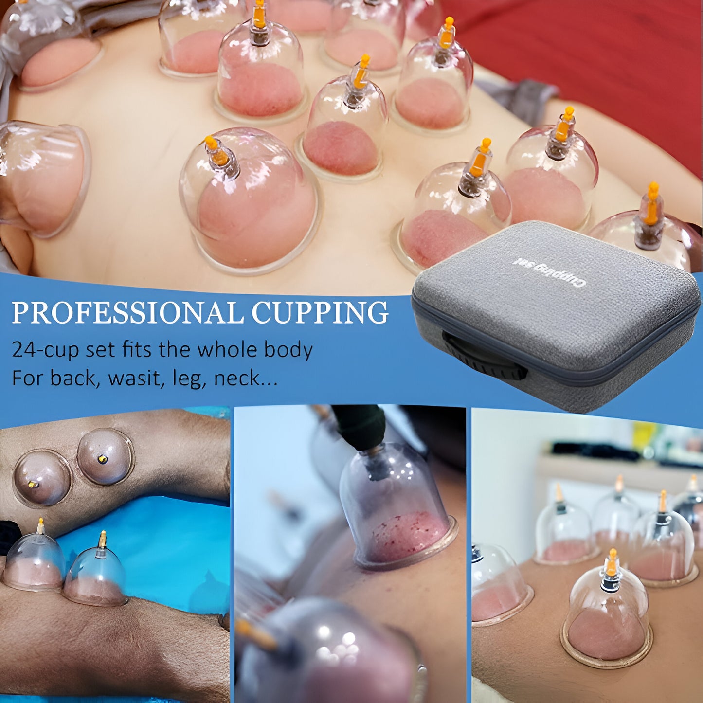 Cupping Therapy Set - Vacuum