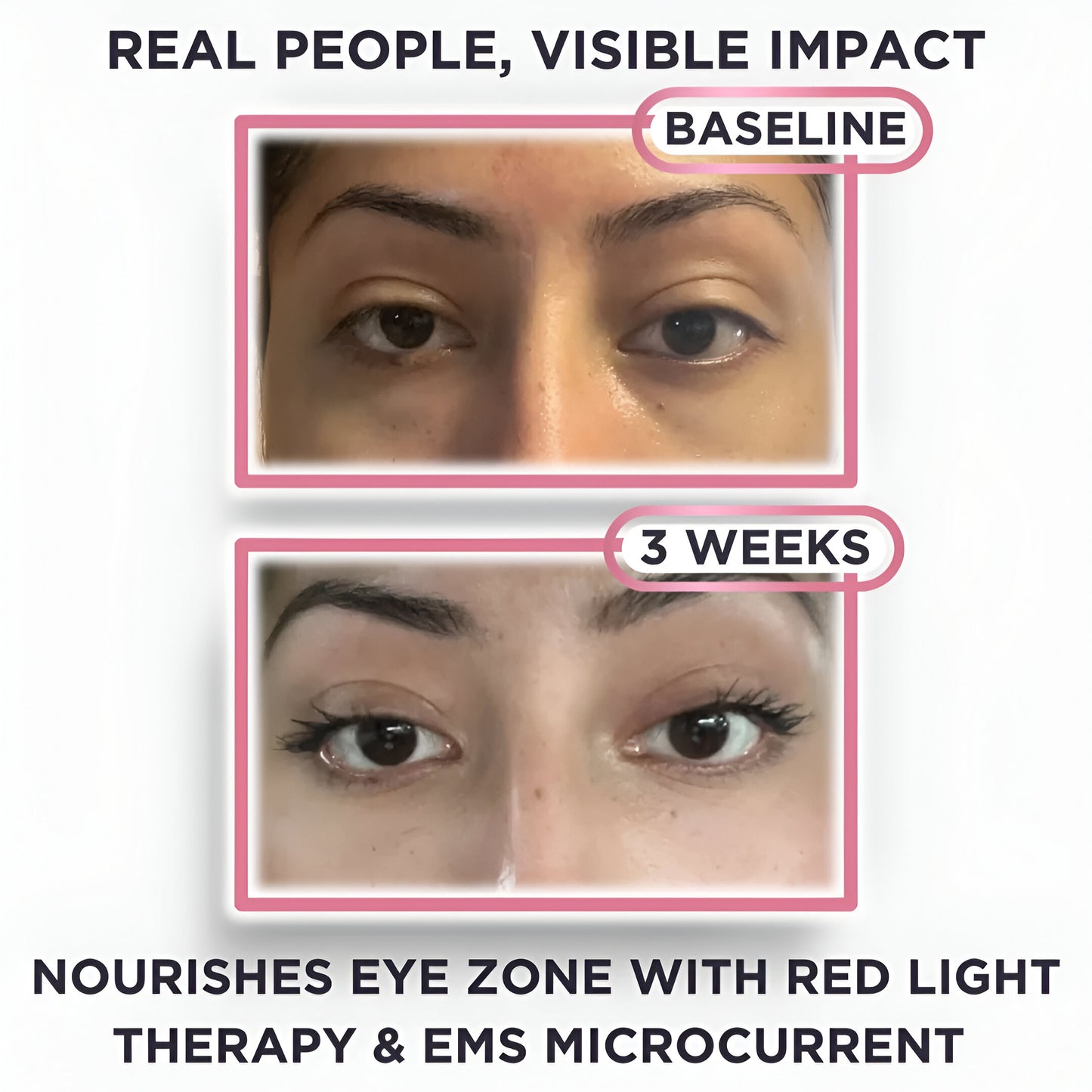 3D Under-Eye Red Light Therapy Glasses